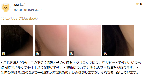 쥬베룩 후기